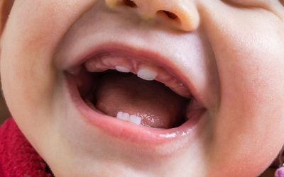 5 remedios para la dentición del bebé que en verdad ayudan