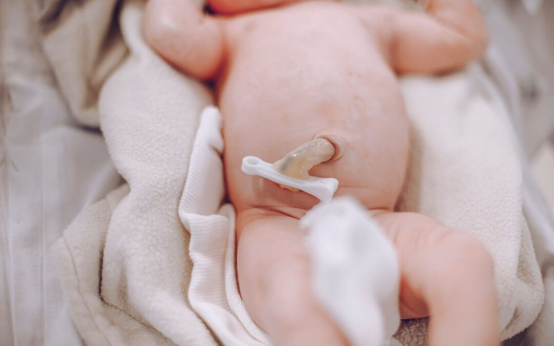 Cuidados del cordón umbilical del recién nacido