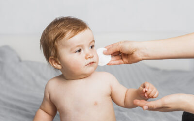 Dermatitis atópica en bebés