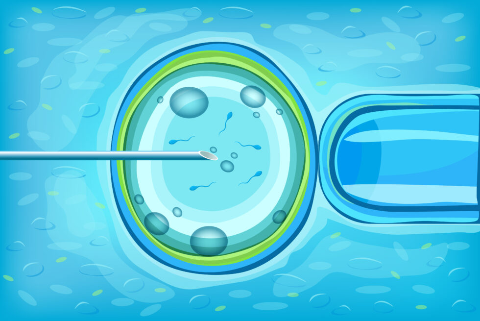 Fecundación in vitro: qué es y en qué consiste